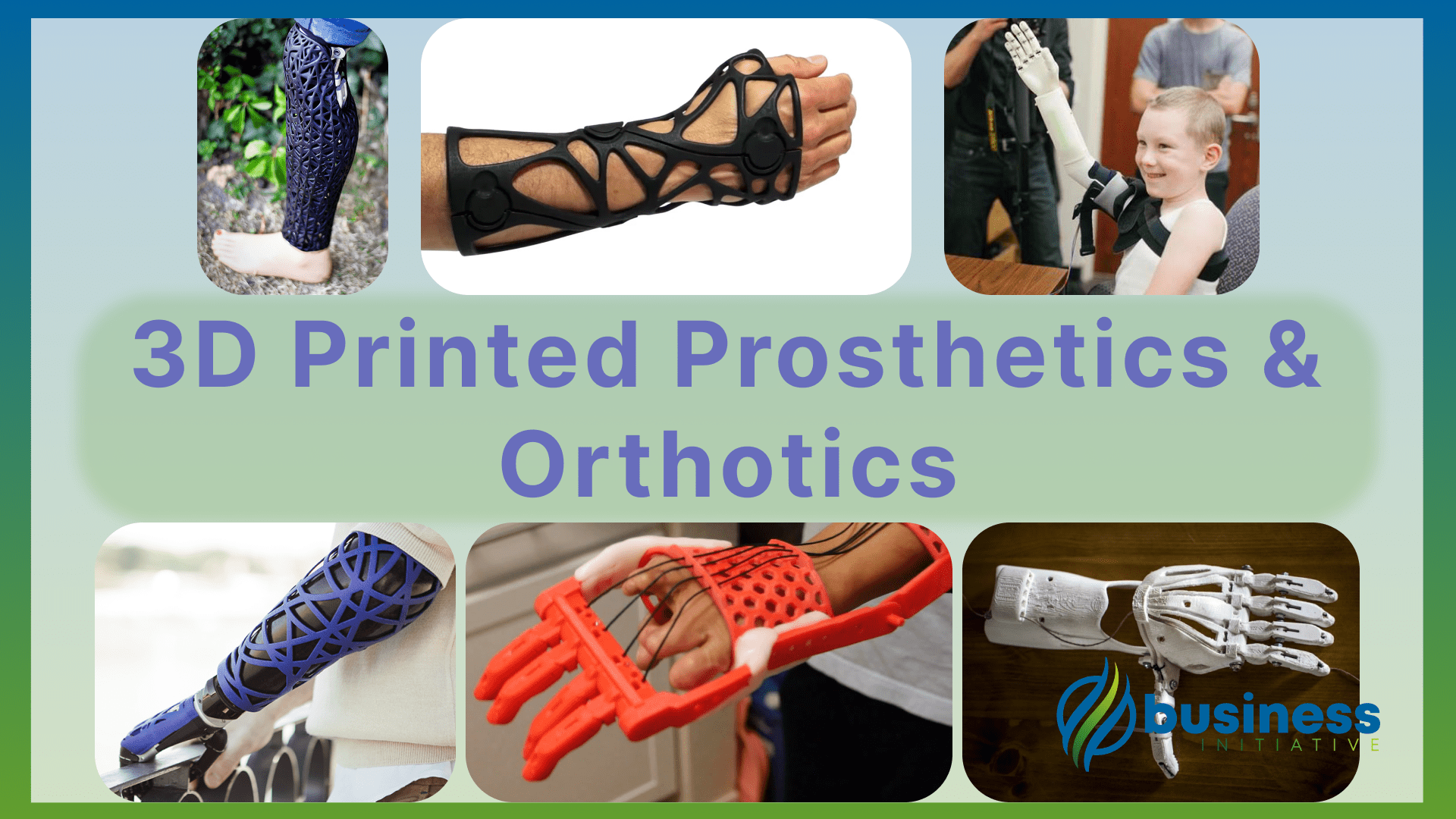 3d printed prosthetics and orthotics