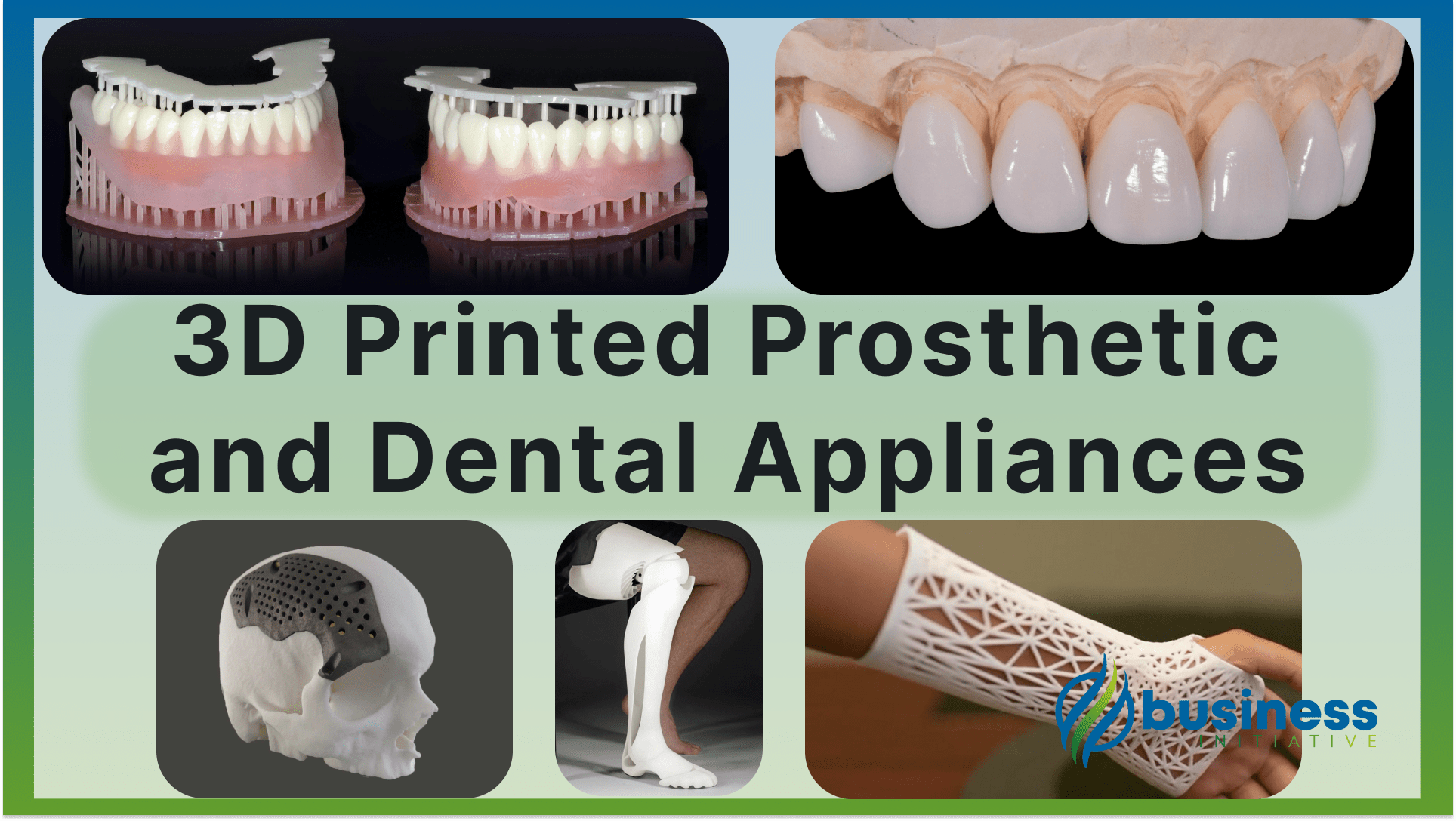 3d printed prosthesis and dental